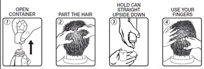 Minoxidil Use Images (Image 02)