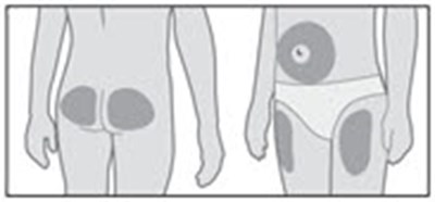 Figure R - genotropin 33